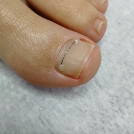 Ортониксия - 70 000 руб.