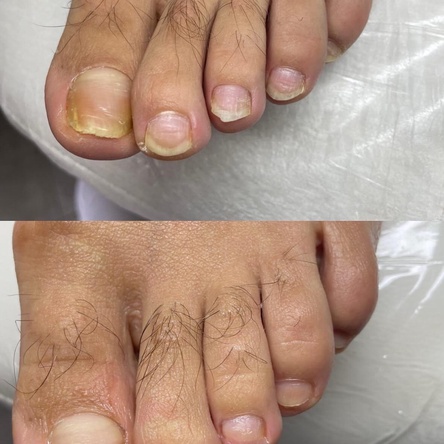 Подология - Восстанавливающий педикюр - 70 000 руб.